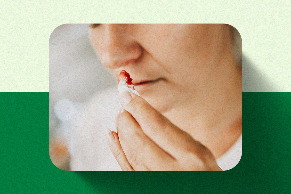 sangramento no nariz